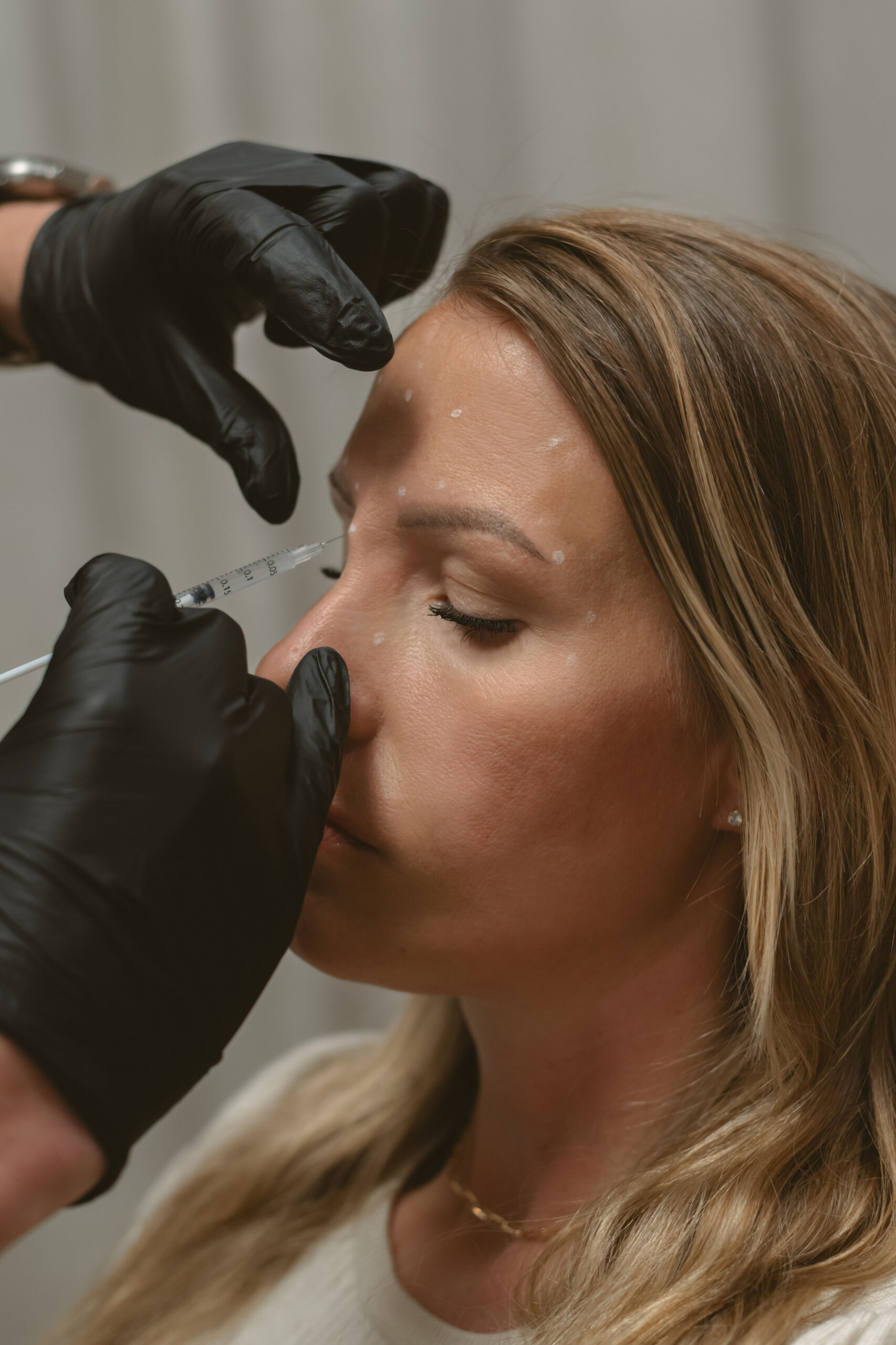 Wrinkle Relaxers (Botox, Daxxify, Dysport, Xeomin)